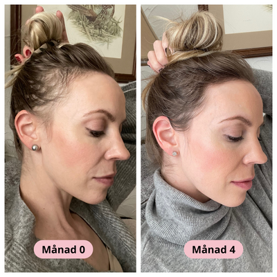 Stella® Hårväxtserum