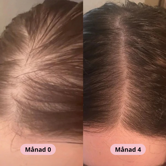 Stella® Hårväxtserum